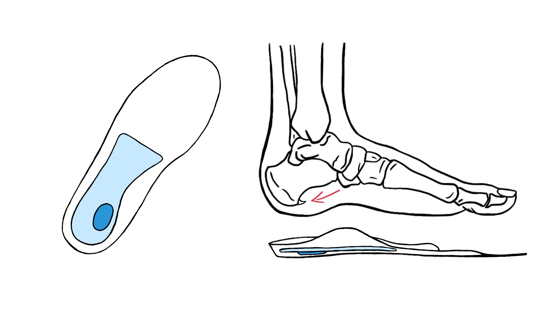 Einlagen im Fertigungsprozess in unserer Werkstatt